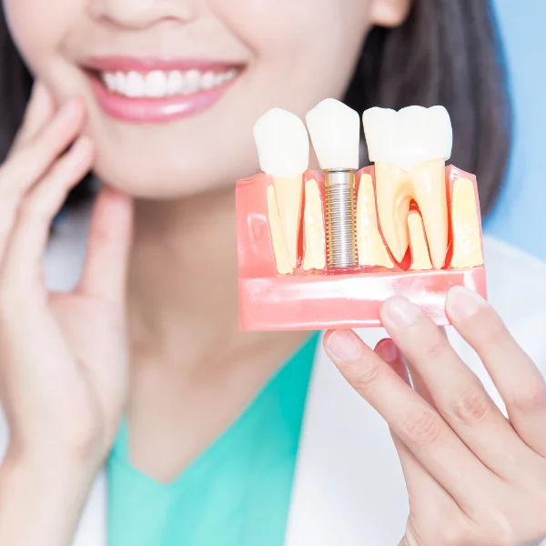Dental Implants